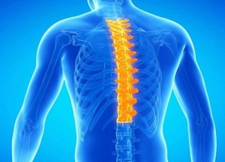 Osteochondróza hrudnej chrbtice