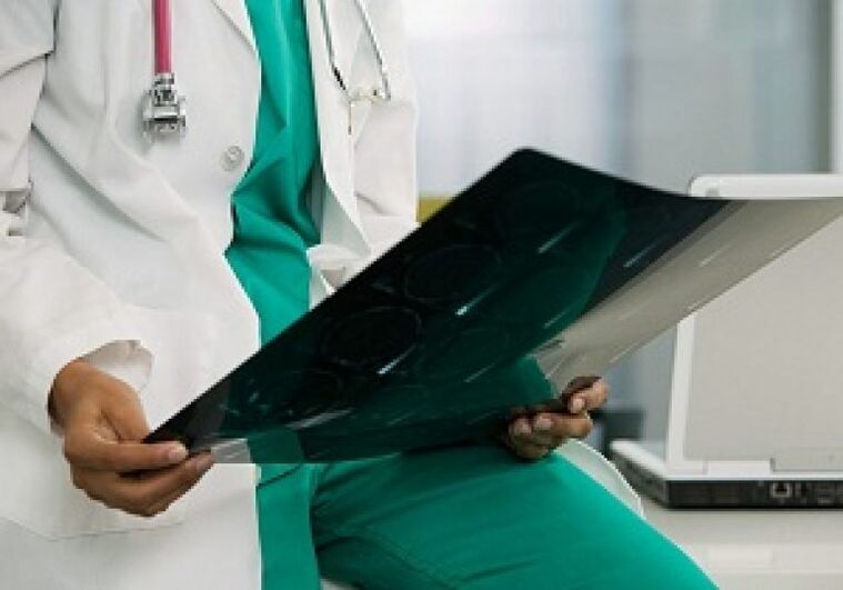 Röntgen pomôže lekárovi diagnostikovať „osteochondrózu hrudnej chrbtice“